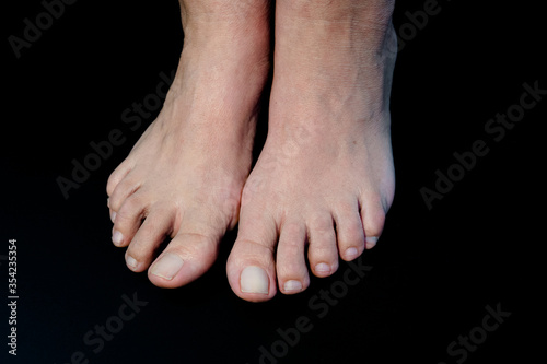 Feet of a Caucasian adult woman on black background