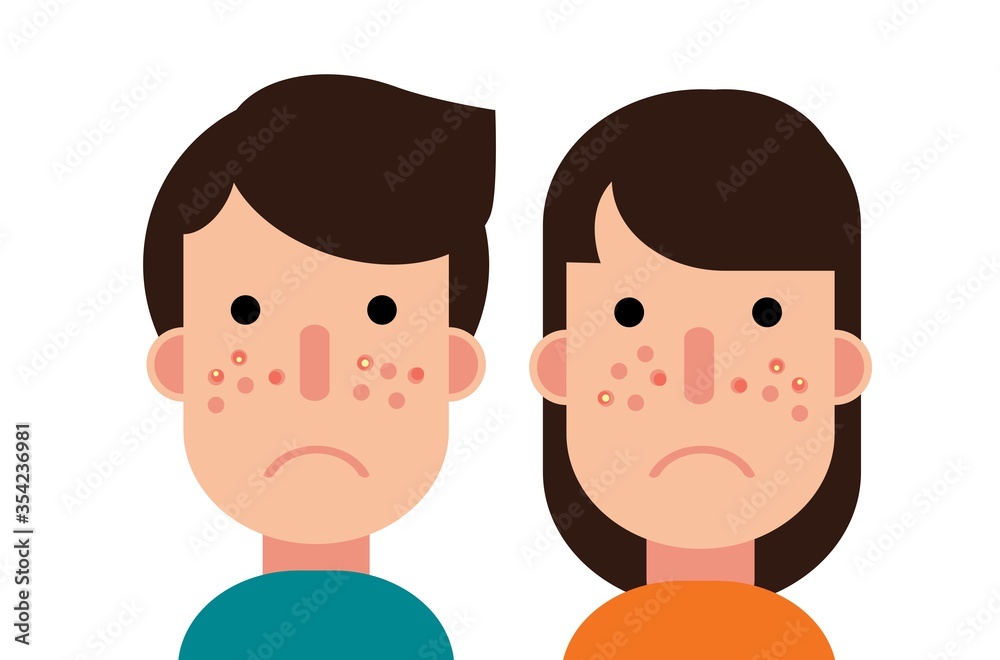 boy and girl with pimples on their face boy and girl with pimples on their face