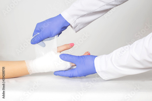 An orthopedic doctor wraps a bandage around a tight bandage on a broken palm and phalanx of the patient s fingers. Concept of fractures of the fingers on the hand, persistent hyperesthesia
