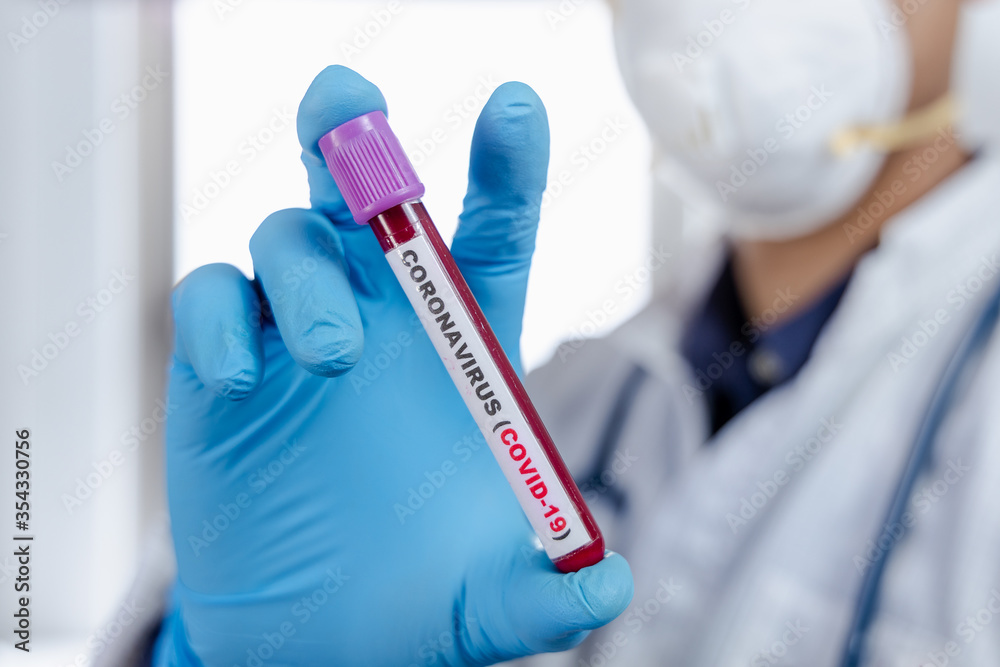 Coronavirus (COVID-19) testng concept, The doctor holds a test tube containing a blood sample.