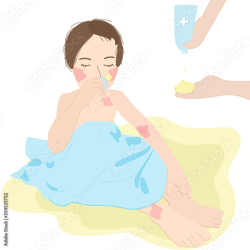 vector illustration of a toddler sitting in a towel after bathing. Mother smears the child with cream, emollient. Humidification. hydration Baby with atopic dermatitis, food Allergy, skin problems.