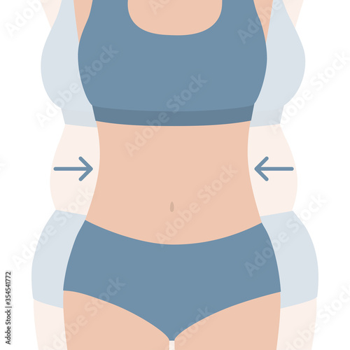Woman body before and after diet and fitness. Body transformation and weight loss concept. Flat vector illustration.