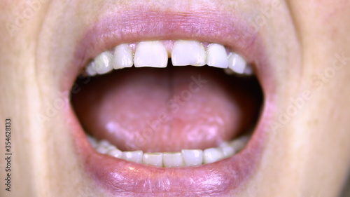 Old woman shows teeth. The upper teeth are straight and the lower crooked. Woman opened her mouth. close-up