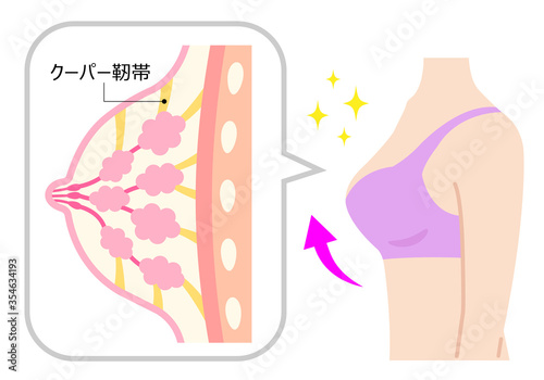 バストアップ,女性,断面図,豊胸,きれい,仕組み,図解,図,組織,断面,美しい,明るい,構造,人体,ボディパーツ,若い,白バック,ブラ,ナイトブラ,美容,胸,おっぱい,乳房,上半身,丸み,クーパー靭帯,エイジング,イラスト,ベクター,明るい,きれい,シンプル,アンチエイジング,ビューティー,デコルテ,乳,美胸,美乳,育乳,バージスライン,谷間,ボリューム,形,バストアップ,ボディケア,ボディライン