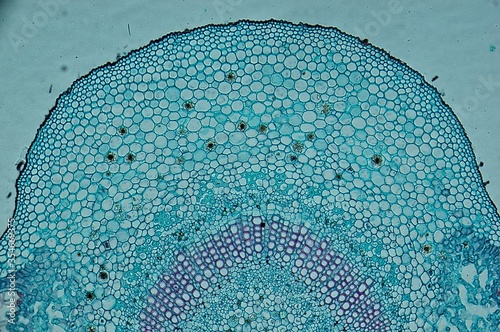 Leiden leaf c.s. under microscope