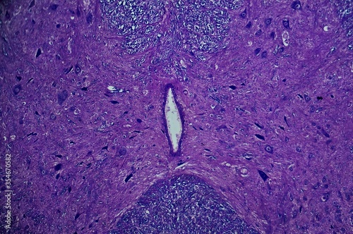 Spinal cord c.s. under microscope