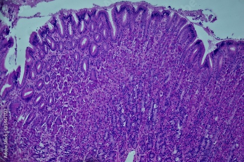 Stomach sec. under microscope close-up