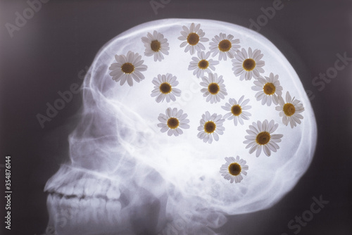 X-ray of the bones of the skull  with white daisies filled in the picture. Medical concept. Flowers and x-ray of the skull. Flowers in the head  with a background on ideas
