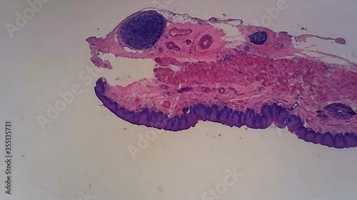 Microscope Human Stratified Squamous Epithelium 1200x Moving photo