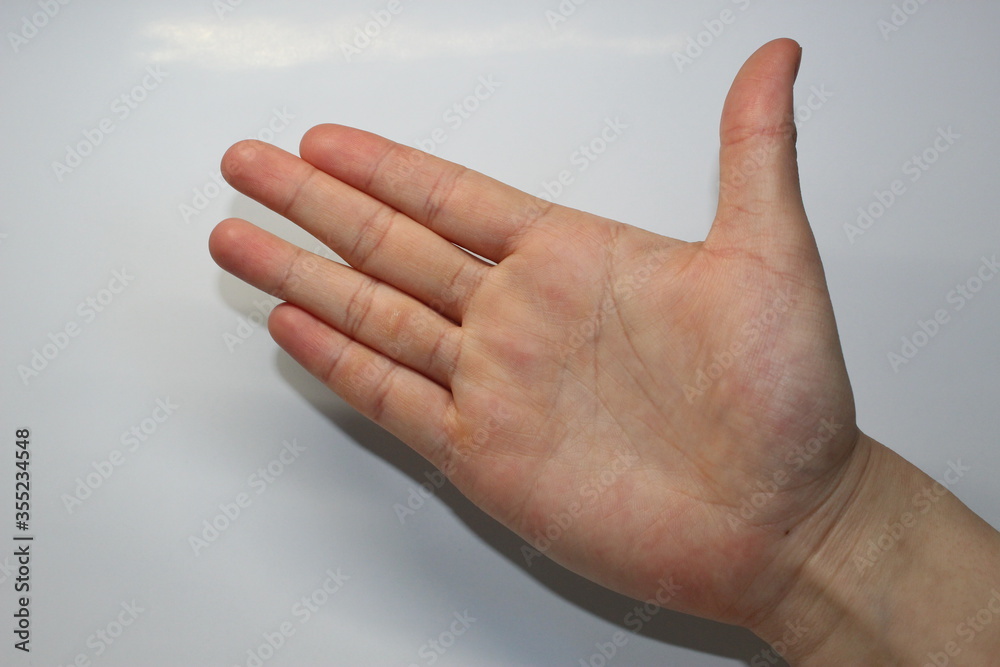 Man's hand in natural open palm position. Calluses on fingers and palm. Man's hand in natural open palm position. Calluses on fingers and palm.