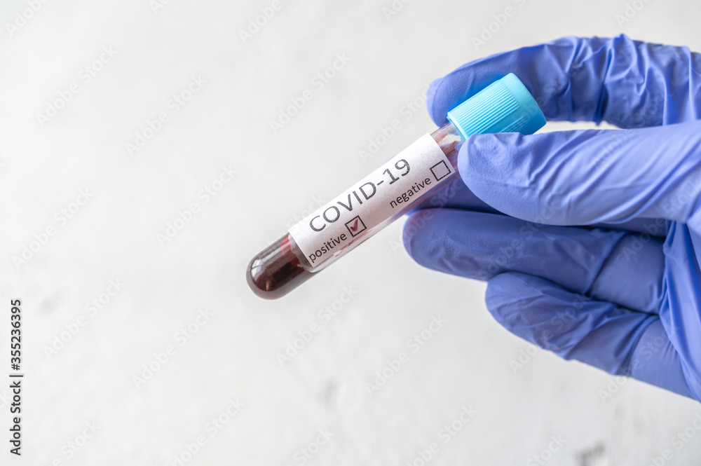 Obraz premium Coronavirus testing