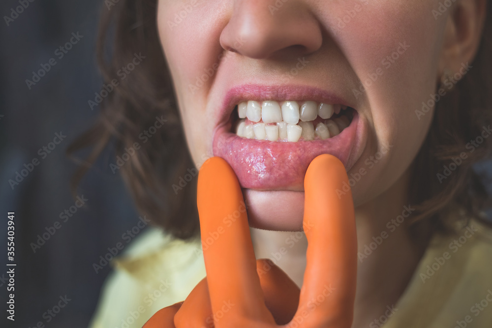 Woman in gloves shows her crooked teeth. Woman in gloves shows her crooked teeth.