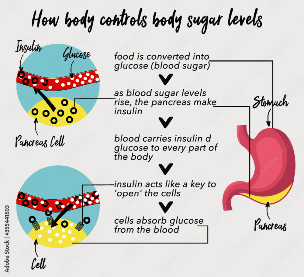 blood sugar levels/insulin infographic Stock Vector | Adobe Stock