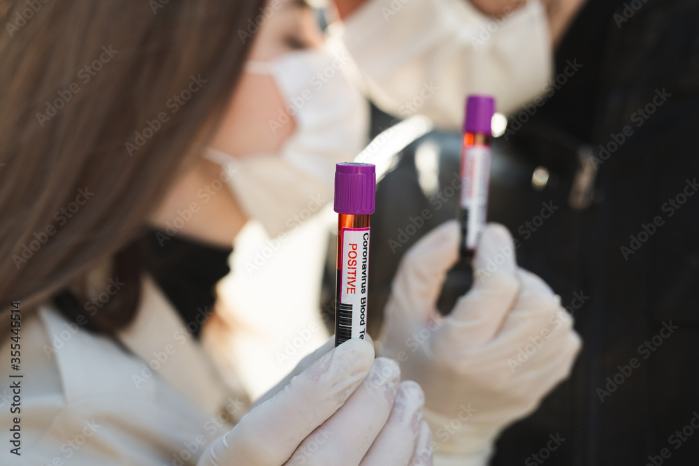 Hands man and woman holds a test tube containing a blood sample, test tube with blood for Covid-19 analyzing. Laboratory testing patient blood. Positive blood test result Hands man and woman holds a test tube containing a blood sample, test tube with blood for Covid-19 analyzing. Laboratory testing patient blood. Positive blood test result