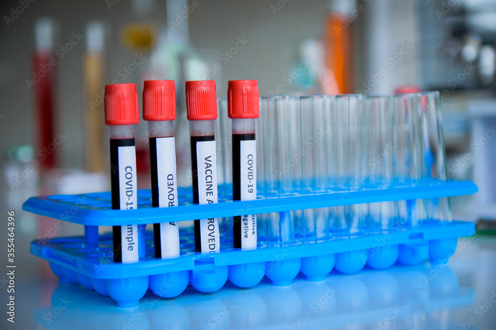 Blood sample research for vaccine corona virus in lab hospital Blood sample research for vaccine corona virus in lab hospital