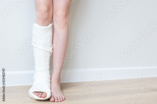 Close-up of children's feet, one leg is broken and in a cast. Light background.