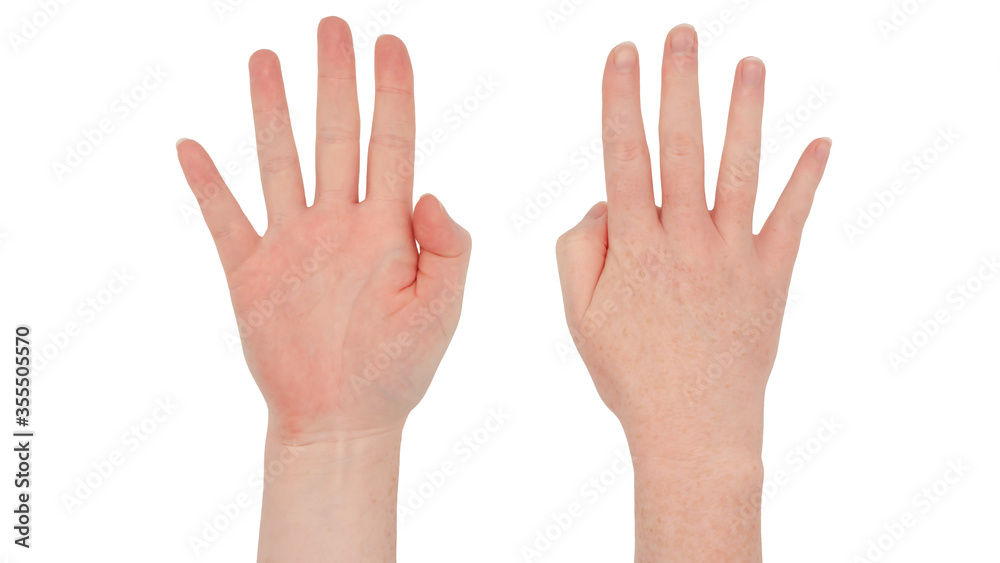 Freckled white hands. Isolated woman's hand with four fingers up and