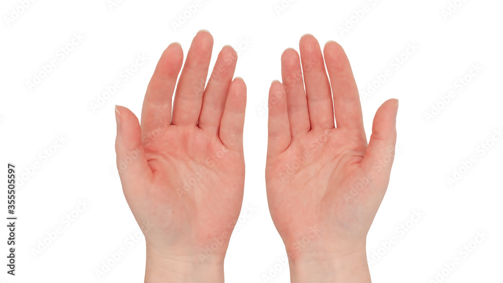 Freckled white hands, Pair of hands come together to make a gentle caring open handed gesture Freckled white hands, Pair of hands come together to make a gentle caring open handed gesture