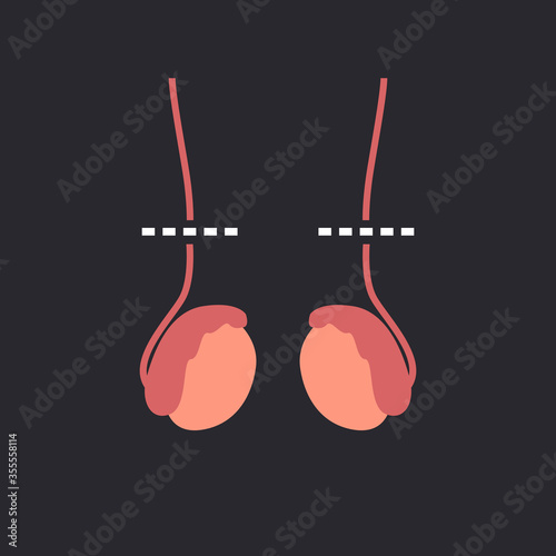 vasectomy flat icon, vector illustration