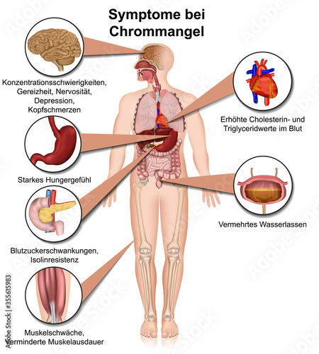 Symptome bei Chrommangel, 3d Infografik isoliert auf weißen Hintergrund mit Beschreibung in deutsch