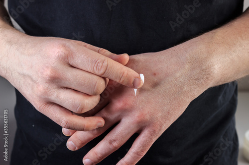 Caucasian young man applying cream on his hand. Man is wearing a black t-shirt. Closeup shot. Groomed man concept.