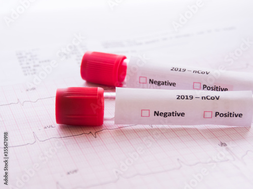 test tube and a tube of blood.