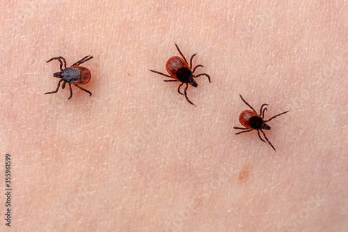 Several dangerous ticks crawl over human skin for a bite. Insects parasites bloodsuckers attack people in forest. Danger of infection with encephalitis or lyme disease. Phobia of stinging arachnids