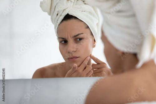 Close up unhappy young woman wearing white bath towel on head squeezing pimple on cheek, standing in bathroom, dissatisfied girl checking face after shower, looking in mirror, skin problem