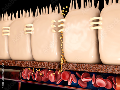 3d Rendering of leaky gut, in intestine with celiac disease and gluten sensitivity these tight junctions come apart. photo