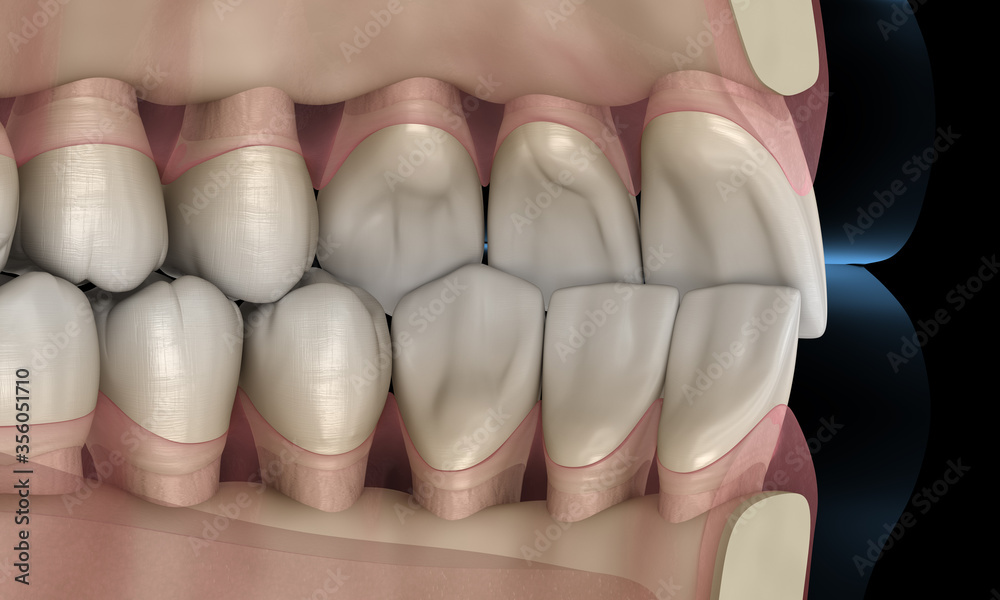 Healthy human teeth with normal occlusion, 3D Illustration