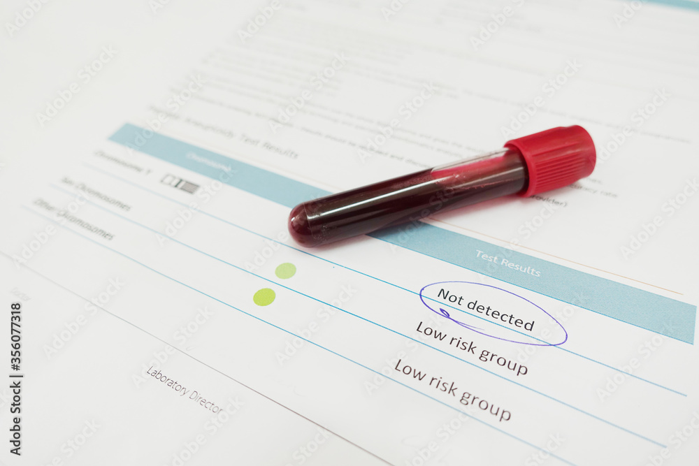 Blood for chromosome testing in laboratory Blood for chromosome testing in laboratory