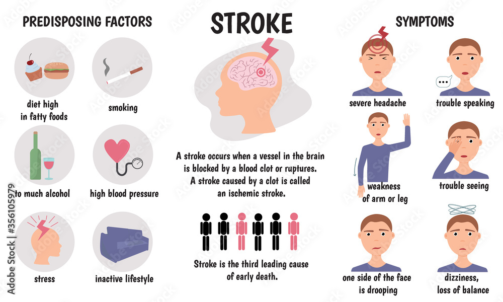 Stroke medical infographic. Stroke symptoms and causes. Vector