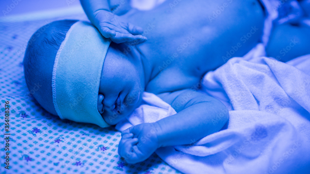 Newborn having a treatment for jaundice under ultraviolet light, Baby