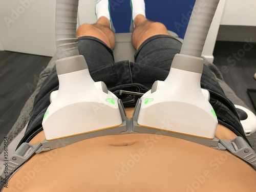 Photography permanet fat loss with non-surgical body sculpting to lose fat at bottom of stom