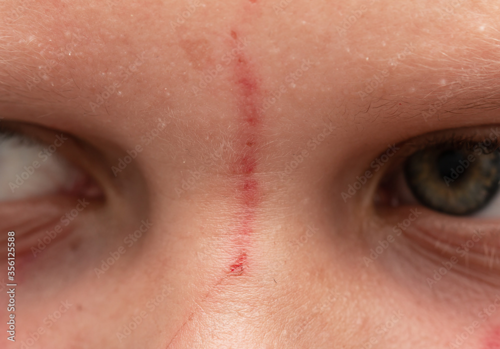 Obraz premium red scratch on the face