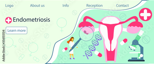 Tiny doctors examine uterus with magnifier to treat endometriosis. Endometriosis, endometrium dysfunctionality, endometriosis treatment concept.Blue background vector for website and mobile website