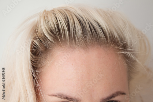 dark roots of hair, overgrown hair. hair roots, color, hair loss or dry scalp problem