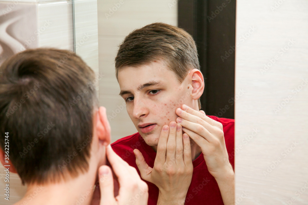 Close up of young attractive man with problematic skin and scars from acne looks in the mirror in the bathroom Close up of young attractive man with problematic skin and scars from acne looks in the mirror in the bathroom