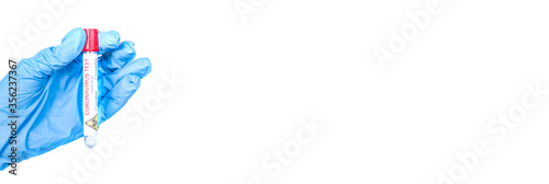 Hand holds a test tube containing a blood sample, test tube with blood for Covid-19 (coronavirus) analyzing