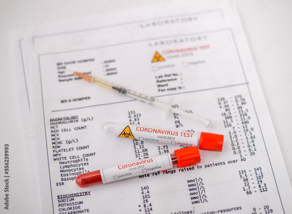 Test tube Covid-19 containing a blood sample on the forms for the coronovirus test analyzing. Laboratory patient’s blood Test tube Covid-19 containing a blood sample on the forms for the coronovirus test analyzing. Laboratory patient’s blood