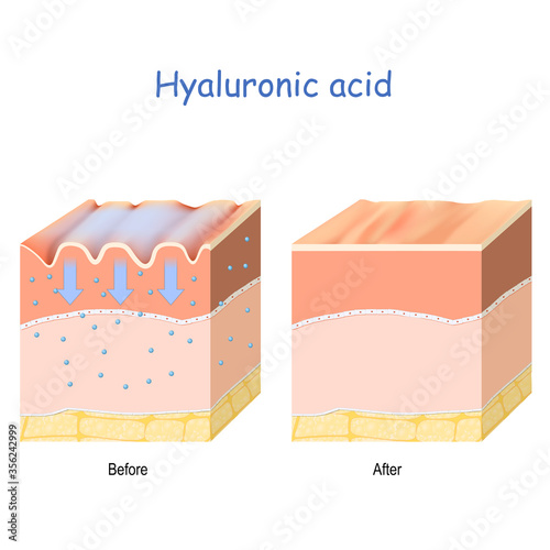 Hyaluronic acid. skin-care products.