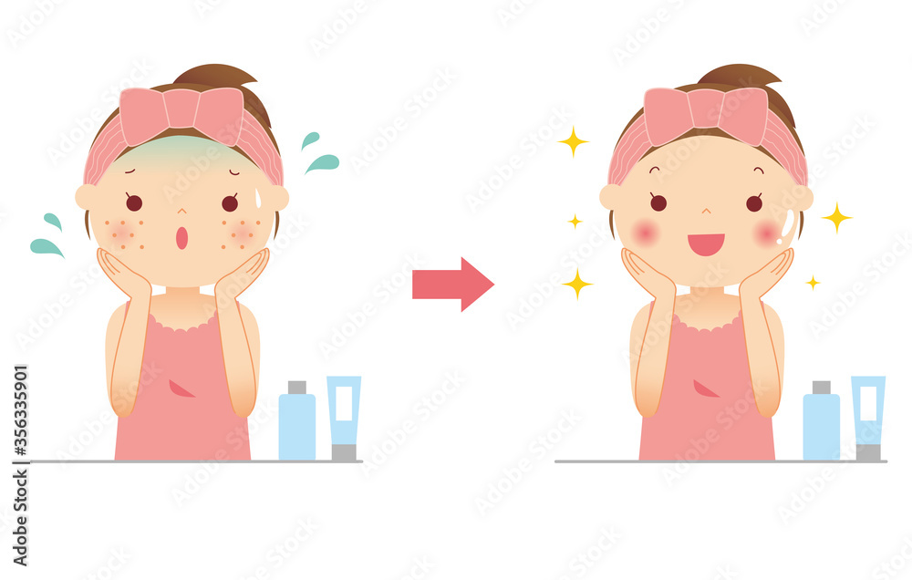 シミとそばかすに悩む若い女性 ビフォーアフター イラスト シミとそばかすに悩む若い女性 ビフォーアフター イラスト