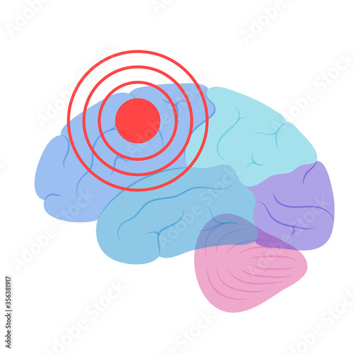 Pain Brain Illustration