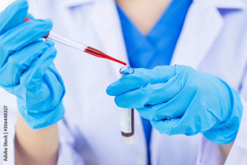 Technician scientist analyzing a blood sample in laboratory, Virus analysis. Technician scientist analyzing a blood sample in laboratory, Virus analysis.