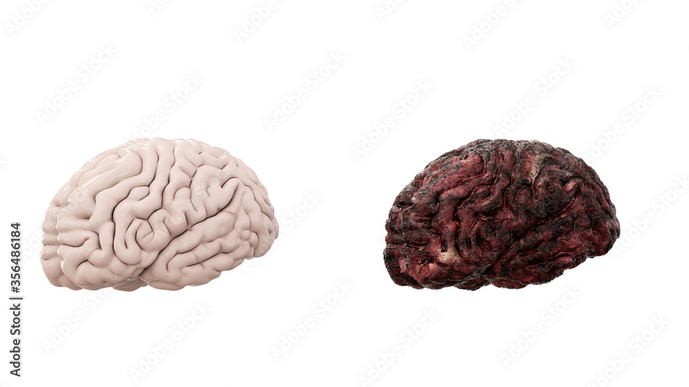 healthy brain and disease brain on white isolate. Autopsy medical concept. Cancer and smoking problem. 3d rendering