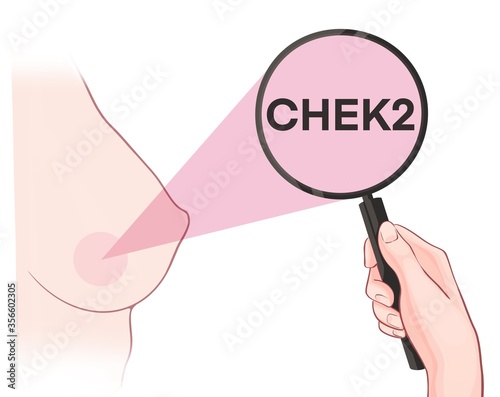 Variants in the CHEK2 gene are associated with an increased risk of developing breast cancer