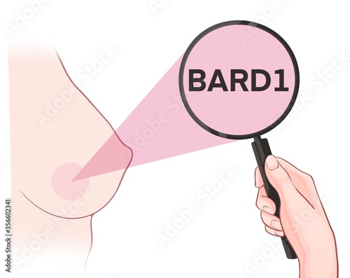 Variants in the BARD1 gene are associated with an increased risk of developing breast cancer