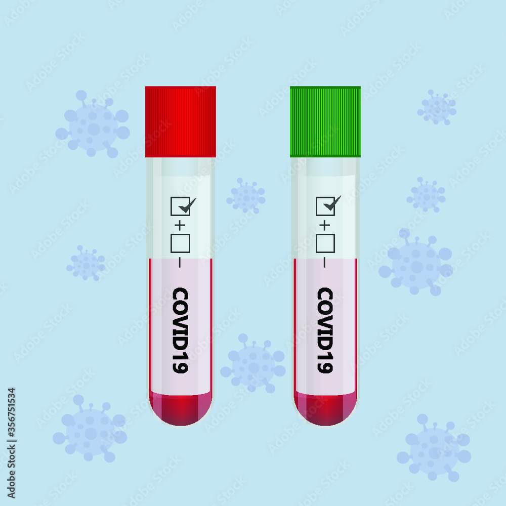 Blood test samples for presence of coronavirus tube containing a blood sample that has tested positive for coronavirus. Blood test samples for presence of coronavirus tube containing a blood sample that has tested positive for coronavirus.