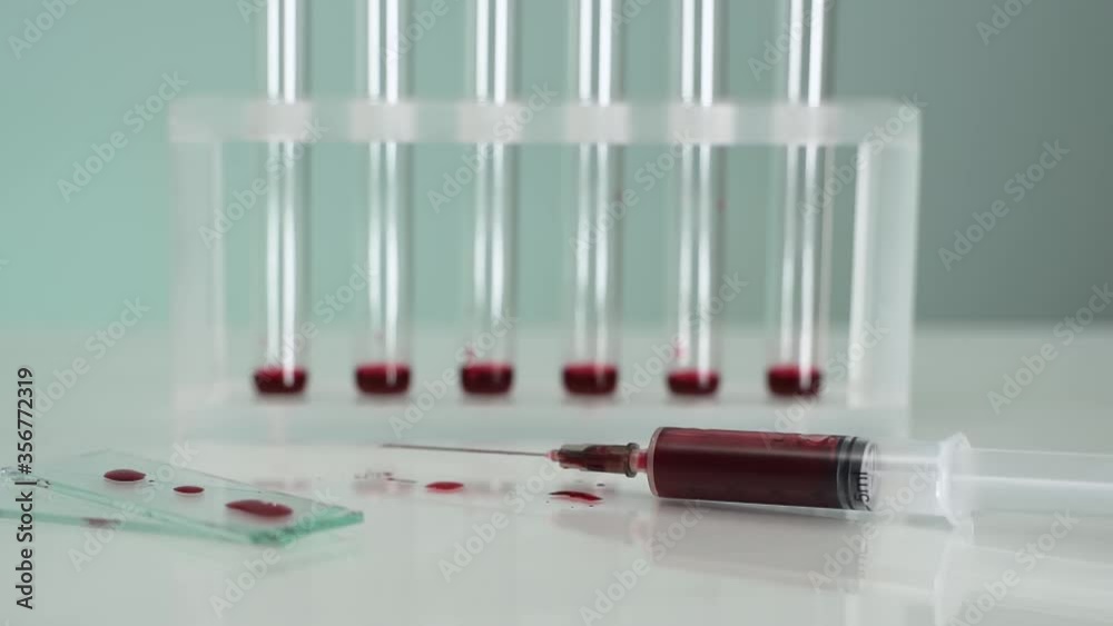 Plastic Syringe falling in front of blood test tubes. Blood collection for tests in slow motion Plastic Syringe falling in front of blood test tubes. Blood collection for tests in slow motion
