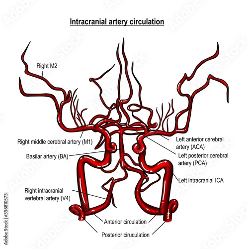 The anatomy describe the distribution of major cerebral arteries including anterior and posterior circulations. 
